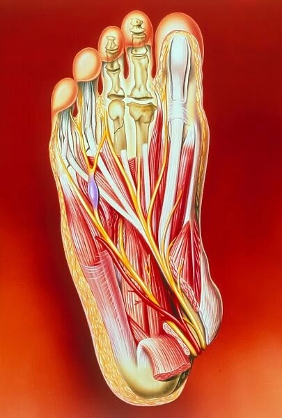 Art of foot: fracture, Kohlers disease, neuritis