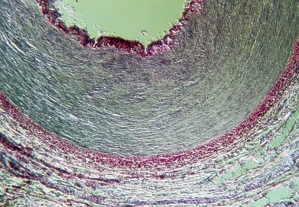 LM cross-section of a healthy human artery