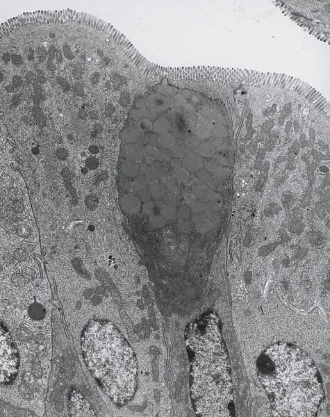 TEM of goblet and secretory cells in duodenum