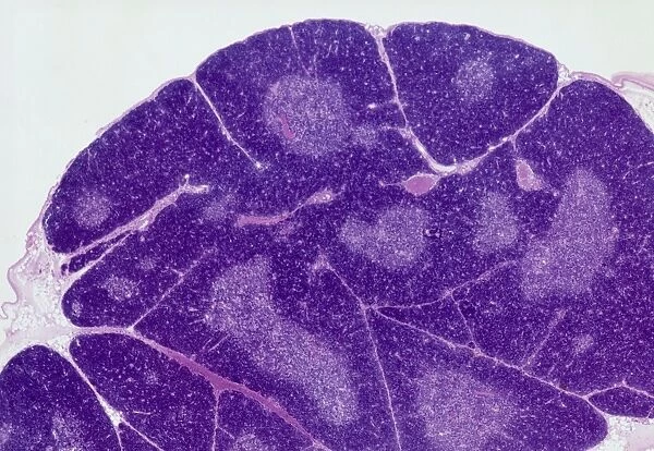 Thymus gland, light micrograph C015  /  4970