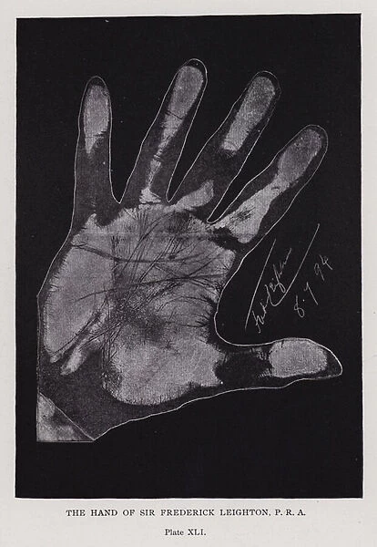 The hand of Sir Frederick Leighton (b  /  w photo)