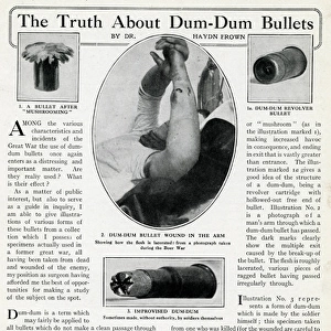 Dum-dum bullets used during WW1