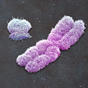 Male sex chromosomes, SEM