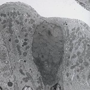 TEM of goblet and secretory cells in duodenum