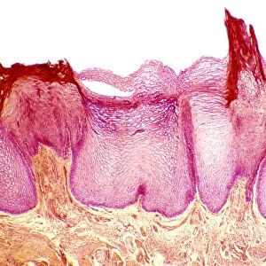 Tongue papillae, light micrograph